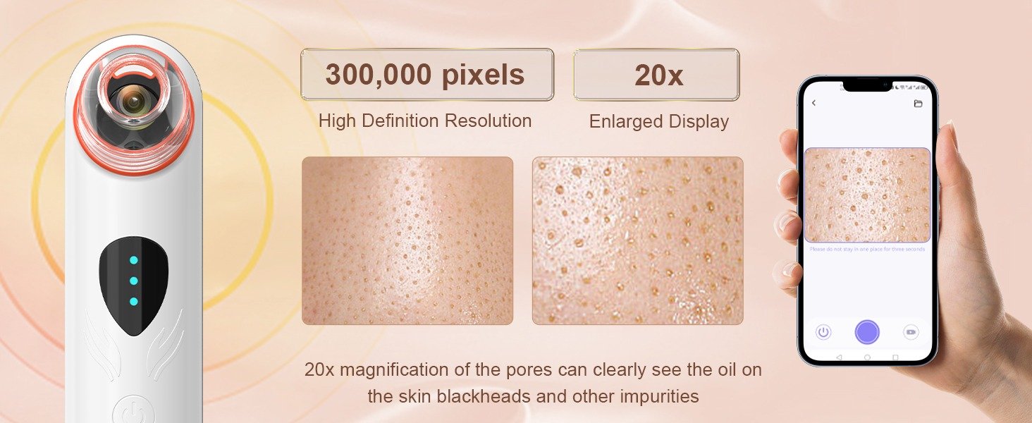 Blackhead Remover