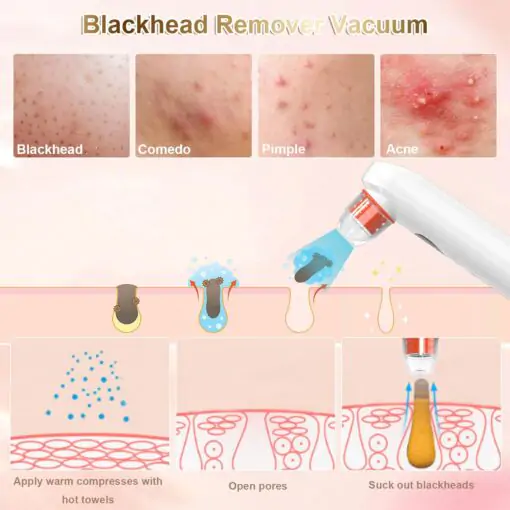 Blackhead Remover-Pore Vacuum,2024 Upgraded Black Head Remover for Face Tool with Camera - Image 2