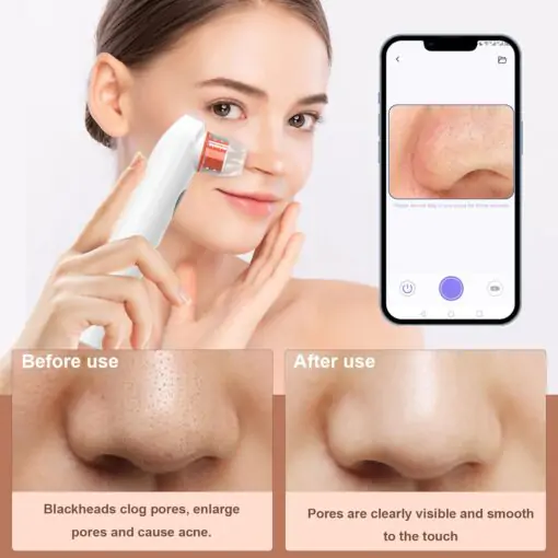 Blackhead Remover-Pore Vacuum,2024 Upgraded Black Head Remover for Face Tool with Camera - Image 3