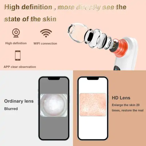 Blackhead Remover-Pore Vacuum,2024 Upgraded Black Head Remover for Face Tool with Camera - Image 4